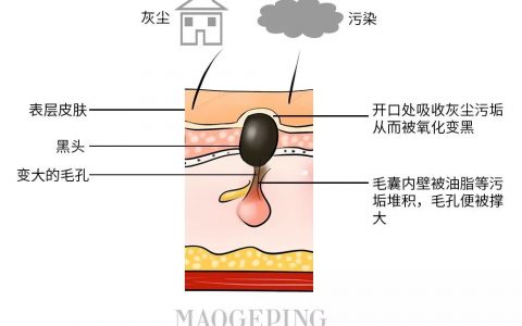 全网最火的4种去黑头方法千万别试