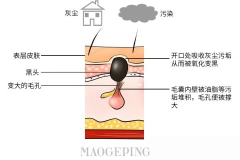 全网最火的4种去黑头方法千万别试