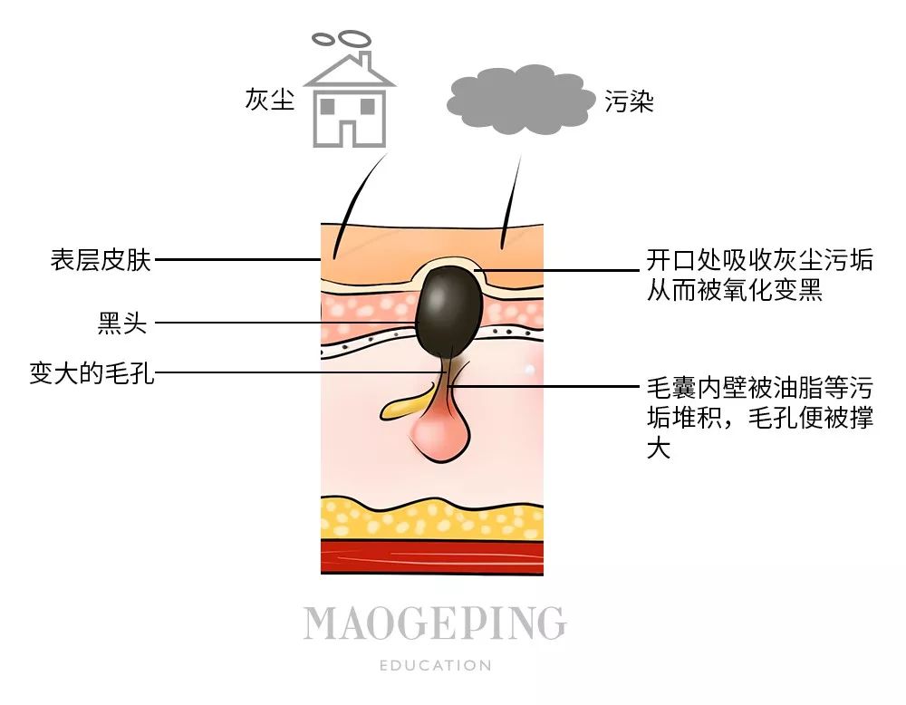 全网最火的4种去黑头方法千万别试